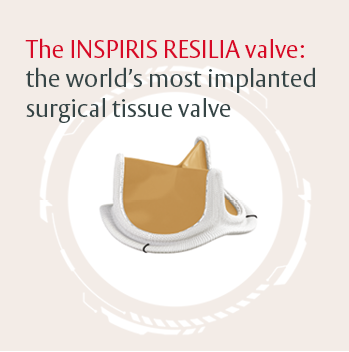 The INSPIRIS RESILIA valve: the world's most implanted surgical tissue valve