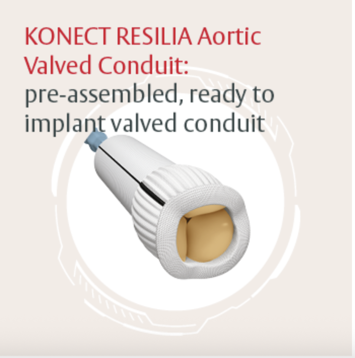 KONECT RESILIA aortic valved conduit: The first and only pre-assembled, ready-to-implant† valved conduit with RESILIA* tissue.