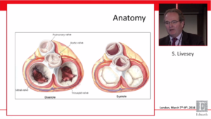 Livesey valve analysis