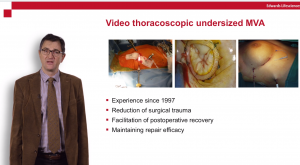 Video thoracoscopic undersized MVA