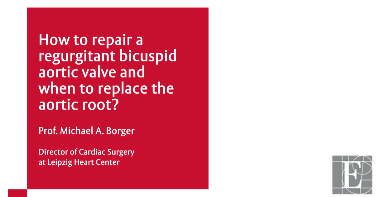How to repair a regurgitant bicuspid aortic valve and when to replace the aortic root?