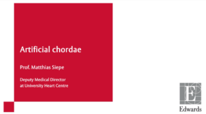 Artificial Chordae